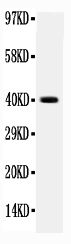 1 - Anti-Integrin Beta 4 Picoband Antibody ABO11732