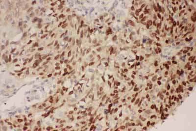 2 - Anti-P53 Picoband Antibody ABO11733