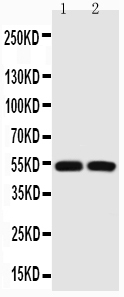 1 - Anti-P53 Picoband Antibody ABO11733