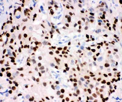 2 - Anti-Progesterone Receptor Picoband Antibody ABO11734