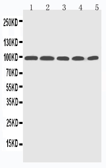 1 - Anti-Progesterone Receptor Picoband Antibody ABO11734