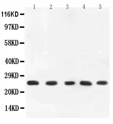 1 - Anti-TNF Alpha Picoband Antibody ABO11735