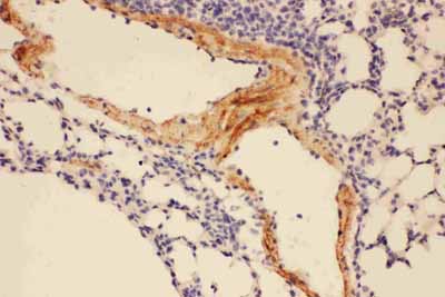 2 - Anti-Adiponectin Picoband Antibody ABO11736