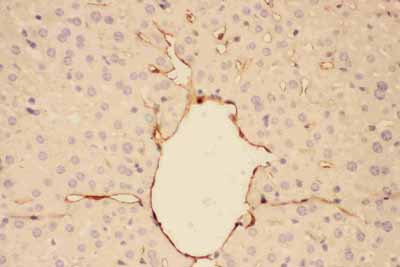 2 - Anti-Adiponectin Picoband Antibody ABO11736
