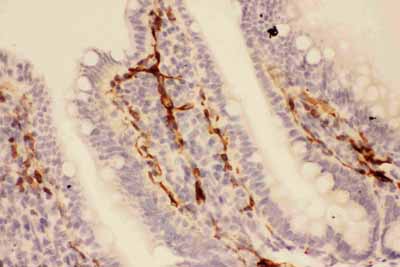2 - Anti-Adiponectin Picoband Antibody ABO11736