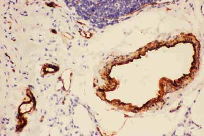 2 - Anti-Adiponectin Picoband Antibody ABO11736