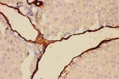 2 - Anti-Adiponectin Picoband Antibody ABO11736