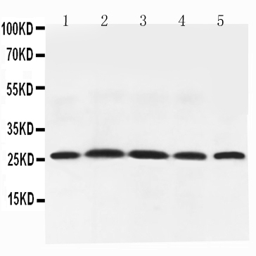 1 - Anti-Adiponectin Picoband Antibody ABO11736