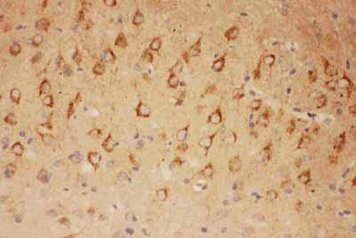 2 - Anti-CNTF Picoband Antibody ABO11737