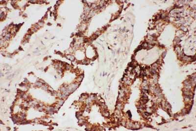 2 - Anti-CNTF Picoband Antibody ABO11737