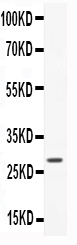 1 - Anti-CNTF Picoband Antibody ABO11737