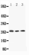 1 - Anti-IL-18 Antibody ABO11739