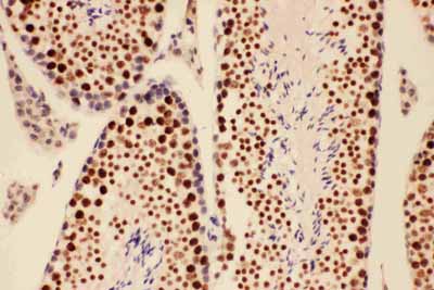 2 - Anti-BRCA1 Picoband Antibody ABO11740