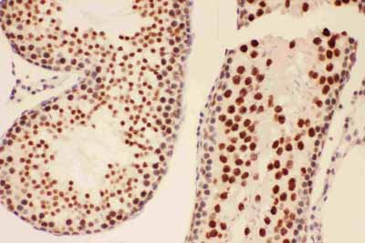 2 - Anti-BRCA1 Picoband Antibody ABO11740