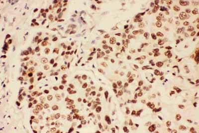 2 - Anti-BRCA1 Picoband Antibody ABO11740