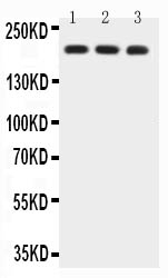1 - Anti-BRCA1 Picoband Antibody ABO11740