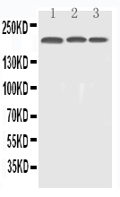 1 - Anti-EGFR Picoband Antibody ABO11741