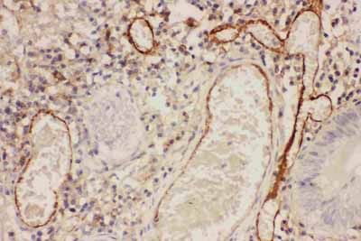 2 - Anti-ICAM-1 Antibody ABO11742