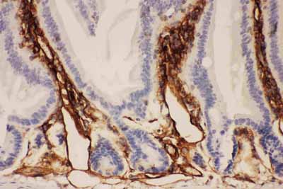2 - Anti-ICAM-1 Antibody ABO11743