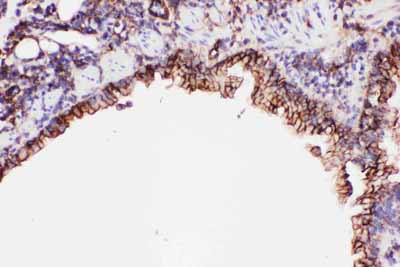 2 - Anti-ICAM-1 Antibody ABO11743