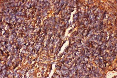 2 - Anti-ICAM-1 Antibody ABO11743