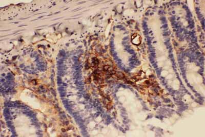 2 - Anti-ICAM-1 Antibody ABO11743