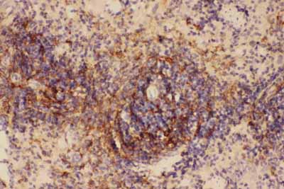 2 - Anti-ICAM-1 Antibody ABO11743