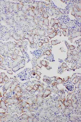 2 - Anti-SAP/PTX2 Antibody ABO11744
