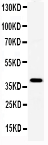 1 - Anti-SAP/PTX2 Antibody ABO11744