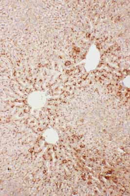 2 - Anti-SAP/PTX2 Antibody ABO11745