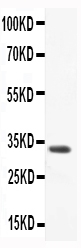 1 - Anti-CCL3 Picoband Antibody ABO11746