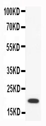 1 - Anti-CCL18/PARC Antibody ABO11747