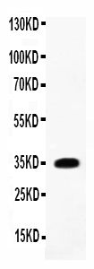 1 - Anti-IL-1 beta Antibody ABO11749