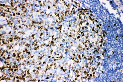 2 - Anti-Ki67 Picoband Antibody ABO11750