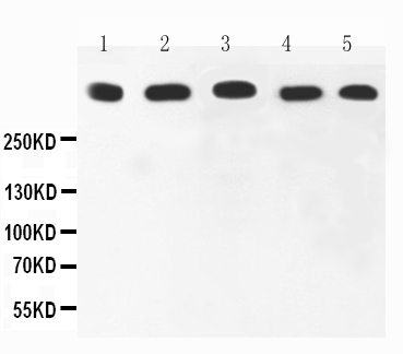 1 - Anti-Ki67 Picoband Antibody ABO11750