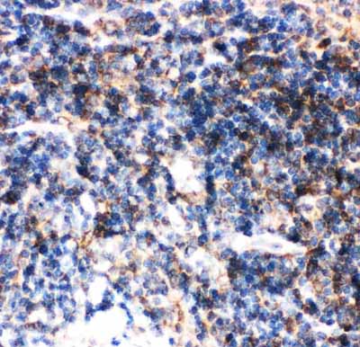 2 - Anti-Bid Picoband Antibody ABO11751