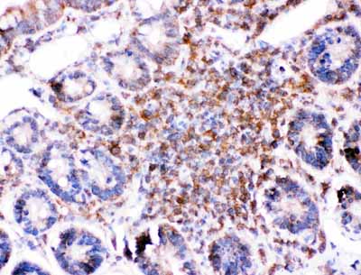 2 - Anti-Bid Picoband Antibody ABO11751