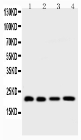 1 - Anti-Bid Picoband Antibody ABO11751