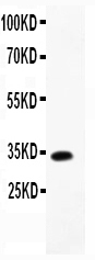 1 - Anti-CCL13/MCP4 Antibody ABO11754
