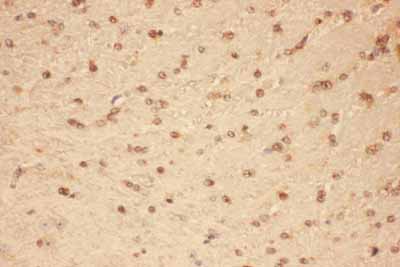 2 - Anti-CNTF Picoband Antibody ABO11756