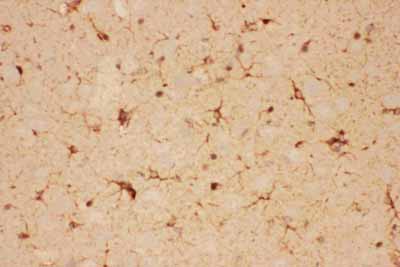 2 - Anti-CNTF Picoband Antibody ABO11756