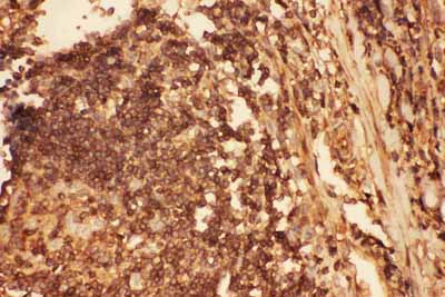 2 - Anti-Cofilin Picoband Antibody ABO11757