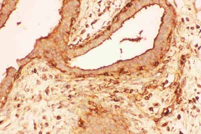 2 - Anti-Cofilin Picoband Antibody ABO11757