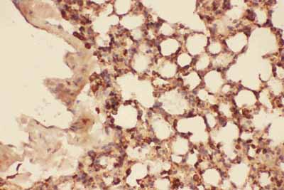 2 - Anti-Cofilin Picoband Antibody ABO11757
