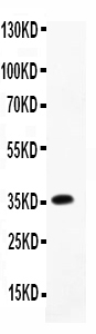 1 - Anti-Cofilin Picoband Antibody ABO11757