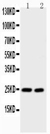 1 - Anti-IL-6 Antibody ABO11758