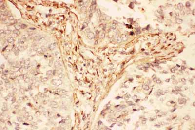 2 - Anti-LIF Picoband Antibody ABO11759