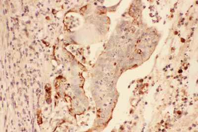 2 - Anti-MMP-7 Antibody ABO11760