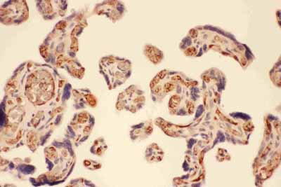 2 - Anti-MMP-7 Antibody ABO11760