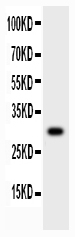 1 - Anti-MMP-7 Antibody ABO11760